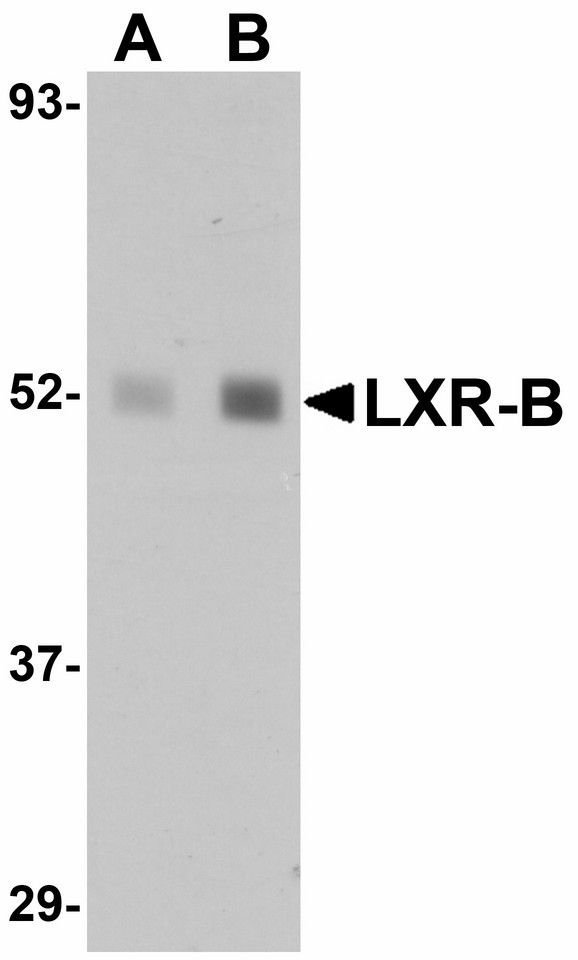NR1H2 / LXR Beta Antibody - Western blot of LXR-B in human lung tissue lysate with LXR-B antibody at (A) 1 and (B) 2 ug/ml.