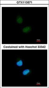 NR1H2 / LXR Beta Antibody - Immunofluorescence of paraformaldehyde-fixed HeLa, using LXR beta antibody at 1:200 dilution.