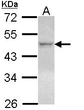 NR1H2 / LXR Beta Antibody - Sample (30 ug of whole cell lysate). A: Hela. 10% SDS PAGE. NR1H2 antibody diluted at 1:1000. 