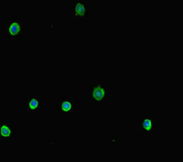 NR1H2 / LXR Beta Antibody - Immunofluorescent analysis of HepG2 cells diluted at 1:100 and Alexa Fluor 488-congugated AffiniPure Goat Anti-Rabbit IgG(H+L)