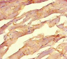 NR1H2 / LXR Beta Antibody - Immunohistochemistry of paraffin-embedded human skeletal muscle tissue at dilution of 1:100
