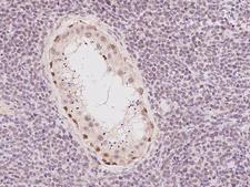 NR1H2 / LXR Beta Antibody - Immunochemical staining of human NR1H2 in human testis with rabbit polyclonal antibody at 1:100 dilution, formalin-fixed paraffin embedded sections.