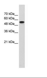 NR1H2 / LXR Beta Antibody - Transfected 293T Cell Lysate.  This image was taken for the unconjugated form of this product. Other forms have not been tested.