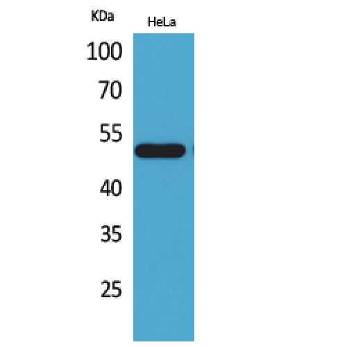 NR1H3 / LXR Alpha Antibody - Western blot of LXRalpha antibody