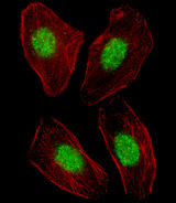 NR1H3 / LXR Alpha Antibody - Fluorescent image of U251 cell stained with NR1H3 Antibody. U251 cells were fixed with 4% PFA (20 min), permeabilized with Triton X-100 (0.1%, 10 min), then incubated with NR1H3 primary antibody (1:25, 1 h at 37°C). For secondary antibody, Alexa Fluor 488 conjugated donkey anti-rabbit antibody (green) was used (1:400, 50 min at 37°C). Cytoplasmic actin was counterstained with Alexa Fluor 555 (red) conjugated Phalloidin (7units/ml, 1 h at 37°C). NR1H3 immunoreactivity is localized to Nucleus significantly.