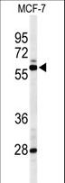 NR1H3 / LXR Alpha Antibody - Western blot of NR1H3 Antibody in MCF-7 cell line lysates (35 ug/lane). NR1H3 (arrow) was detected using the purified antibody.