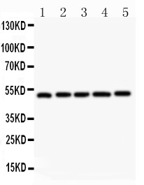 NR1H3 / LXR Alpha Antibody - NR1H3 antibody Western blot. All lanes: Anti NR1H3 at 0.5 ug/ml. Lane 1: Rat Liver Tissue Lysate at 50 ug. Lane 2: Rat Lung Tissue Lysate at 50 ug. Lane 3: Rat Spleen Tissue Lysate at 50 ug. Lane 4: Rat Kidney Tissue Lysate at 50 ug. Lane 5: Human Placenta Tissue Lysate at 50 ug. Predicted band size: 51 kD. Observed band size: 51 kD.