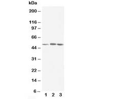 NR1H3 / LXR Alpha Antibody - Western blot testing of NR1H3 antibody and Lane 1: rat liver; 2: MCF-7; 3: HeLa cell lysate