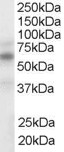 NR1H3 / LXR Alpha Antibody - NR1H3 / LXR Alpha antibody (1ug/ml) staining of Human Spleen lysate (35ug protein in RIPA buffer). Detected by chemiluminescence.