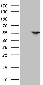 NR1H3 / LXR Alpha Antibody - HEK293T cells were transfected with the pCMV6-ENTRY control. (Left lane) or pCMV6-ENTRY NR1H3. (Right lane) cDNA for 48 hrs and lysed. Equivalent amounts of cell lysates. (5 ug per lane) were separated by SDS-PAGE and immunoblotted with anti-NR1H3. (1:2000)