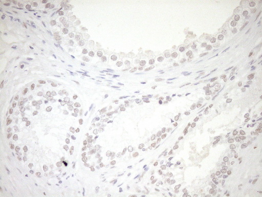 NR1H3 / LXR Alpha Antibody - Immunohistochemical staining of paraffin-embedded Human prostate tissue within the normal limits using anti-NR1H3 mouse monoclonal antibody. (Heat-induced epitope retrieval by 1mM EDTA in 10mM Tris buffer. (pH8.5) at 120°C for 3 min. (1:150)