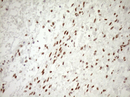NR1H3 / LXR Alpha Antibody - Immunohistochemical staining of paraffin-embedded Human Ovary tissue within the normal limits using anti-NR1H3 mouse monoclonal antibody. (Heat-induced epitope retrieval by 1mM EDTA in 10mM Tris buffer. (pH8.5) at 120°C for 3 min. (1:150)