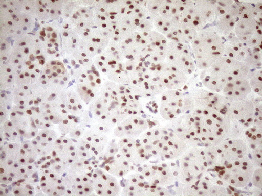 NR1H3 / LXR Alpha Antibody - Immunohistochemical staining of paraffin-embedded Human pancreas tissue within the normal limits using anti-NR1H3 mouse monoclonal antibody. (Heat-induced epitope retrieval by 1mM EDTA in 10mM Tris buffer. (pH8.5) at 120°C for 3 min. (1:150)
