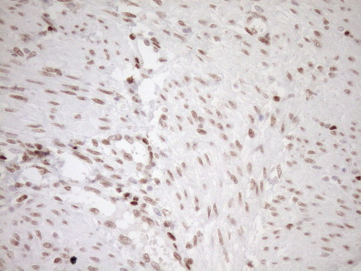 NR1H3 / LXR Alpha Antibody - Immunohistochemical staining of paraffin-embedded Human endometrium tissue within the normal limits using anti-NR1H3 mouse monoclonal antibody. (Heat-induced epitope retrieval by 1mM EDTA in 10mM Tris buffer. (pH8.5) at 120°C for 3 min. (1:150)