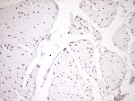 NR1H3 / LXR Alpha Antibody - Immunohistochemical staining of paraffin-embedded Human bladder tissue within the normal limits using anti-NR1H3 mouse monoclonal antibody. (Heat-induced epitope retrieval by 1mM EDTA in 10mM Tris buffer. (pH8.5) at 120°C for 3 min. (1:150)