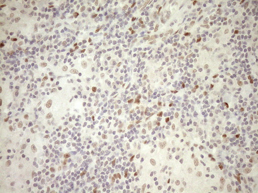 NR1H3 / LXR Alpha Antibody - Immunohistochemical staining of paraffin-embedded Human lymph node tissue within the normal limits using anti-NR1H3 mouse monoclonal antibody. (Heat-induced epitope retrieval by 1mM EDTA in 10mM Tris buffer. (pH8.5) at 120°C for 3 min. (1:150)