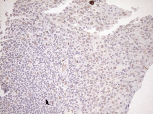 NR1H3 / LXR Alpha Antibody - Immunohistochemical staining of paraffin-embedded Human tonsil within the normal limits using anti-NR1H3 mouse monoclonal antibody. (Heat-induced epitope retrieval by 1mM EDTA in 10mM Tris buffer. (pH8.5) at 120°C for 3 min. (1:150)