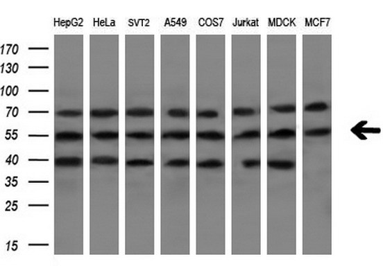 NR1H3 / LXR Alpha Antibody - Western blot analysis of extracts. (10ug) from 8 different cell lines by using anti-NR1H3 monoclonal antibody. (1:200)