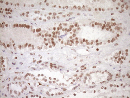 NR1H3 / LXR Alpha Antibody - Immunohistochemical staining of paraffin-embedded Human Kidney tissue within the normal limits using anti-NR1H3 mouse monoclonal antibody. (Heat-induced epitope retrieval by 1mM EDTA in 10mM Tris buffer. (pH8.5) at 120°C for 3 min. (1:150)