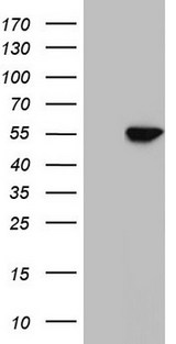 NR1H3 / LXR Alpha Antibody - HEK293T cells were transfected with the pCMV6-ENTRY control (Left lane) or pCMV6-ENTRY NR1H3 (Right lane) cDNA for 48 hrs and lysed. Equivalent amounts of cell lysates (5 ug per lane) were separated by SDS-PAGE and immunoblotted with anti-NR1H3.