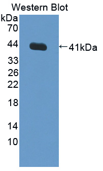 NR1H3 / LXR Alpha Antibody - Western blot of NR1H3 / LXR Alpha antibody.