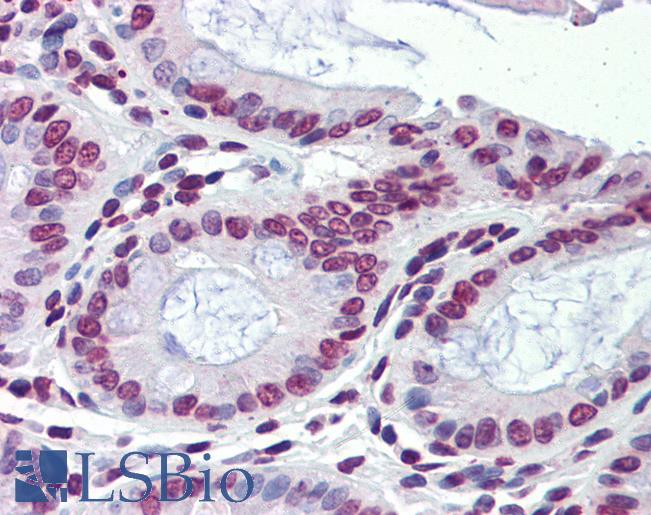 NR1H3 / LXR Alpha Antibody - Anti-NR1H3 / LXR Alpha antibody IHC of human colon. Immunohistochemistry of formalin-fixed, paraffin-embedded tissue after heat-induced antigen retrieval. Antibody concentration 5 ug/ml.  This image was taken for the unconjugated form of this product. Other forms have not been tested.