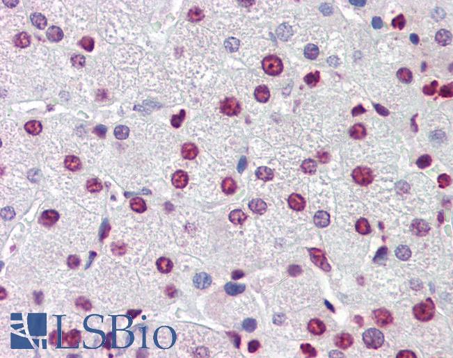 NR1H3 / LXR Alpha Antibody - Anti-NR1H3 / LXR Alpha antibody IHC of human liver. Immunohistochemistry of formalin-fixed, paraffin-embedded tissue after heat-induced antigen retrieval. Antibody concentration 5 ug/ml.  This image was taken for the unconjugated form of this product. Other forms have not been tested.