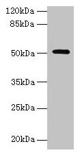 NR1H3 / LXR Alpha Antibody - Western blot All lanes: Oxysterols receptor LXR-alpha antibody at 6µg/ml + Mouse liver tissue Secondary Goat polyclonal to rabbit IgG at 1/10000 dilution Predicted band size: 51, 44, 46 kDa Observed band size: 51 kDa