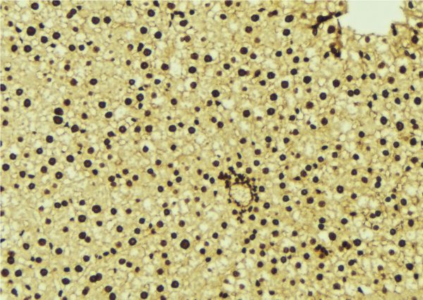 NR1H3 / LXR Alpha Antibody - 1:100 staining mouse liver tissue by IHC-P. The sample was formaldehyde fixed and a heat mediated antigen retrieval step in citrate buffer was performed. The sample was then blocked and incubated with the antibody for 1.5 hours at 22°C. An HRP conjugated goat anti-rabbit antibody was used as the secondary.