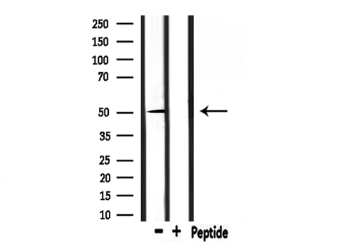 NR1H3 / LXR Alpha Antibody - Western blot analysis of extracts of mouse brain tissue using NR1H3 antibody.