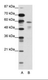 NR1H3 / LXR Alpha Antibody - A: Marker, B: Jurkat Cell Lysate.  This image was taken for the unconjugated form of this product. Other forms have not been tested.