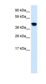 NR1H4 / FXR Antibody - NR1H4 antibody Western blot of Fetal lung lysate. This image was taken for the unconjugated form of this product. Other forms have not been tested.