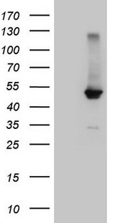 NR1H4 / FXR Antibody - HEK293T cells were transfected with the pCMV6-ENTRY control. (Left lane) or pCMV6-ENTRY NR1H4. (Right lane) cDNA for 48 hrs and lysed. Equivalent amounts of cell lysates. (5 ug per lane) were separated by SDS-PAGE and immunoblotted with anti-NR1H4. (1:2000)