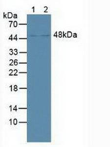 NR1H4 / FXR Antibody - Western Blot; Sample: Lane1: Human Liver Tissue; Lane2: Mouse Kidney Tissue.