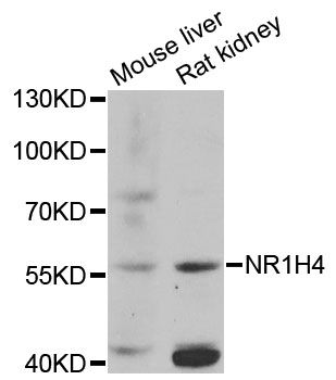 NR1H4 / FXR Antibody - Western blot analysis of extracts of various cell lines, using NR1H4 antibody at 1:1000 dilution. The secondary antibody used was an HRP Goat Anti-Rabbit IgG (H+L) at 1:10000 dilution. Lysates were loaded 25ug per lane and 3% nonfat dry milk in TBST was used for blocking. An ECL Kit was used for detection and the exposure time was 60s.