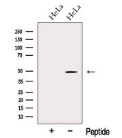NR1H4 / FXR Antibody - Western blot analysis of extracts of HeLa cells using NR1H4 antibody. The lane on the left was treated with blocking peptide.