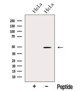 NR1H4 / FXR Antibody - Western blot analysis of extracts of HeLa cells using NR1H4 antibody. The lane on the left was treated with blocking peptide.