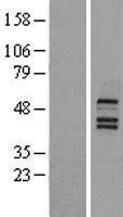 NR1H4 / FXR Protein - Western validation with an anti-DDK antibody * L: Control HEK293 lysate R: Over-expression lysate