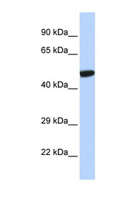 NR1I2 / PXR Antibody - NR1I2 / PXR antibody Western blot of HeLa lysate. This image was taken for the unconjugated form of this product. Other forms have not been tested.
