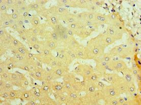 NR1I2 / PXR Antibody - Immunohistochemistry of paraffin-embedded human liver tissue using antibody at 1:100 dilution.