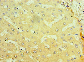 NR1I2 / PXR Antibody - Immunohistochemistry of paraffin-embedded human liver tissue using NR1I2 Antibody at dilution of 1:100