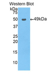 NR1I2 / PXR Antibody - Western blot of recombinant NR1I2 / PXR / PAR.  This image was taken for the unconjugated form of this product. Other forms have not been tested.