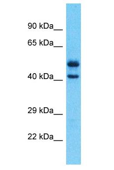 NR1I2 / PXR Antibody - NR1I2 / PXR / PAR antibody Western Blot of Uterus Tumor. Antibody dilution: 1 ug/ml.  This image was taken for the unconjugated form of this product. Other forms have not been tested.