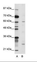 NR1I2 / PXR Antibody - A: Marker, B: Jurkat Cell Lysate.  This image was taken for the unconjugated form of this product. Other forms have not been tested.