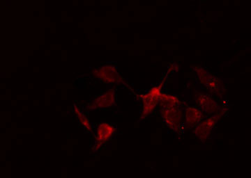 NR1I2 / PXR Antibody - Staining HeLa cells by IF/ICC. The samples were fixed with PFA and permeabilized in 0.1% Triton X-100, then blocked in 10% serum for 45 min at 25°C. The primary antibody was diluted at 1:200 and incubated with the sample for 1 hour at 37°C. An Alexa Fluor 594 conjugated goat anti-rabbit IgG (H+L) antibody, diluted at 1/600, was used as secondary antibody.