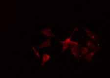 NR1I2 / PXR Antibody - Staining HeLa cells by IF/ICC. The samples were fixed with PFA and permeabilized in 0.1% Triton X-100, then blocked in 10% serum for 45 min at 25°C. The primary antibody was diluted at 1:200 and incubated with the sample for 1 hour at 37°C. An Alexa Fluor 594 conjugated goat anti-rabbit IgG (H+L) antibody, diluted at 1/600, was used as secondary antibody.