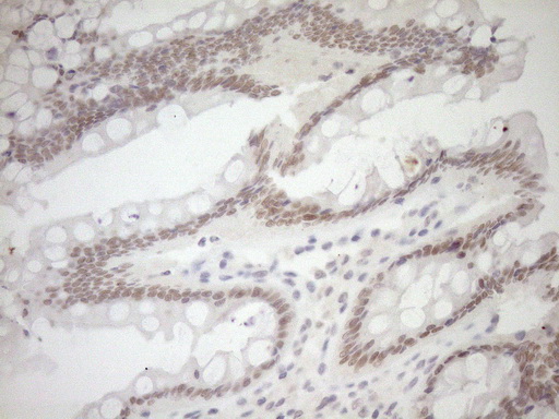 NR1I3 / CAR Antibody - Immunohistochemical staining of paraffin-embedded Human colon tissue within the normal limits using anti-NR1I3 mouse monoclonal antibody. (Heat-induced epitope retrieval by 1mM EDTA in 10mM Tris buffer. (pH8.5) at 120°C for 3 min. (1:150)