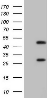 NR1I3 / CAR Antibody - HEK293T cells were transfected with the pCMV6-ENTRY control. (Left lane) or pCMV6-ENTRY NR1I3. (Right lane) cDNA for 48 hrs and lysed. Equivalent amounts of cell lysates. (5 ug per lane) were separated by SDS-PAGE and immunoblotted with anti-NR1I3.