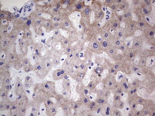 NR1I3 / CAR Antibody - Immunohistochemical staining of paraffin-embedded Human liver tissue within the normal limits using anti-NR1I3 mouse monoclonal antibody. (Heat-induced epitope retrieval by 1 mM EDTA in 10mM Tris, pH8.5, 120C for 3min,