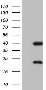 NR1I3 / CAR Antibody - HEK293T cells were transfected with the pCMV6-ENTRY control. (Left lane) or pCMV6-ENTRY NR1I3. (Right lane) cDNA for 48 hrs and lysed. Equivalent amounts of cell lysates. (5 ug per lane) were separated by SDS-PAGE and immunoblotted with anti-NR1I3.